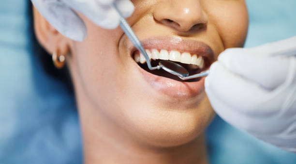 Best Chipped Tooth Repair Near Me  in Rose Hills, CA